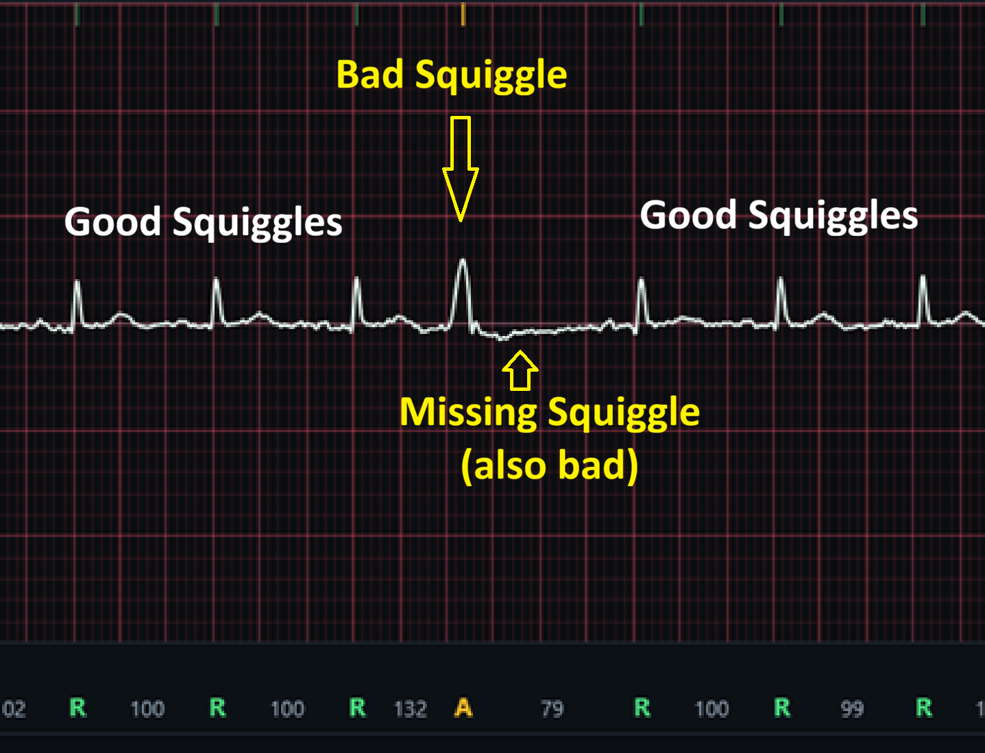 Danger Squiggles!