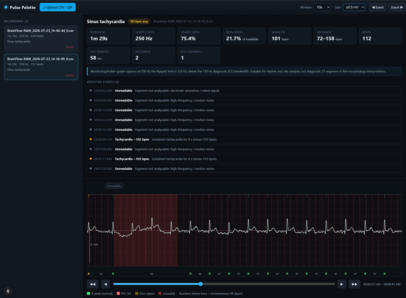 OpenBCI UI